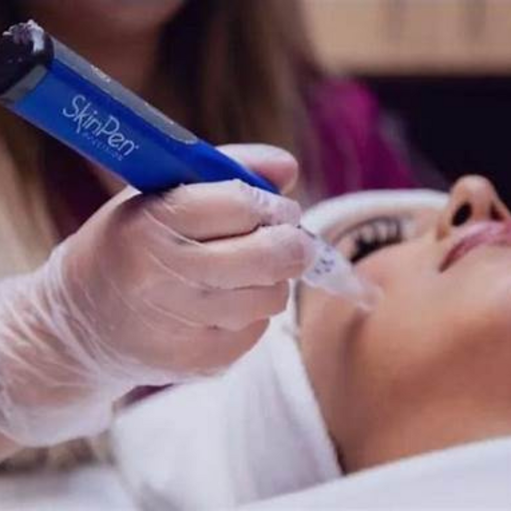 The Benefits of Microneedling: What to Expect from Skin Mix at Denver