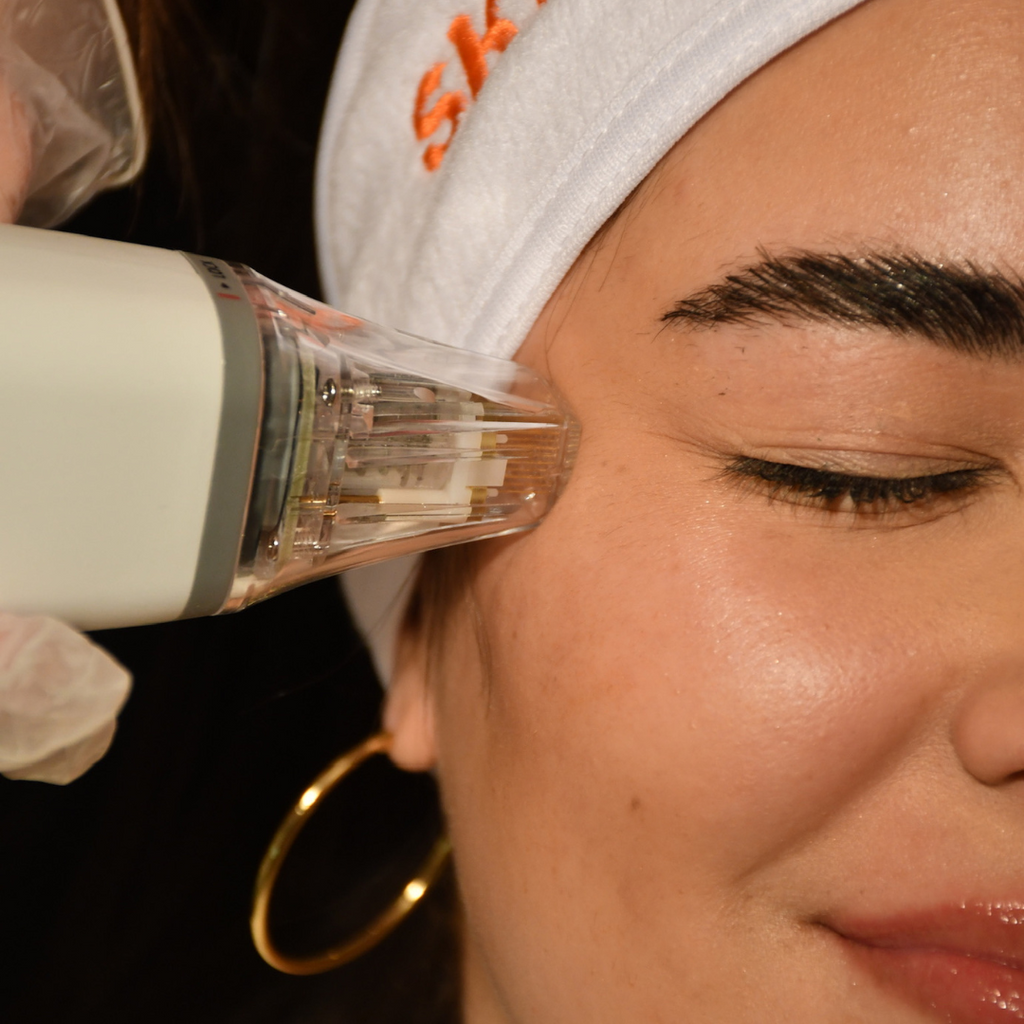How Does Radio Frequency Microneedling with Potenza Help with Anti-Aging