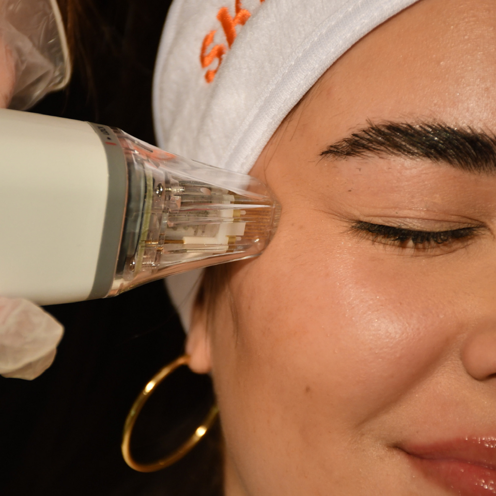 Denver’s Top Medspa for RF Microneedling: Skin Rejuvenation at Skin Mix Medical Spa