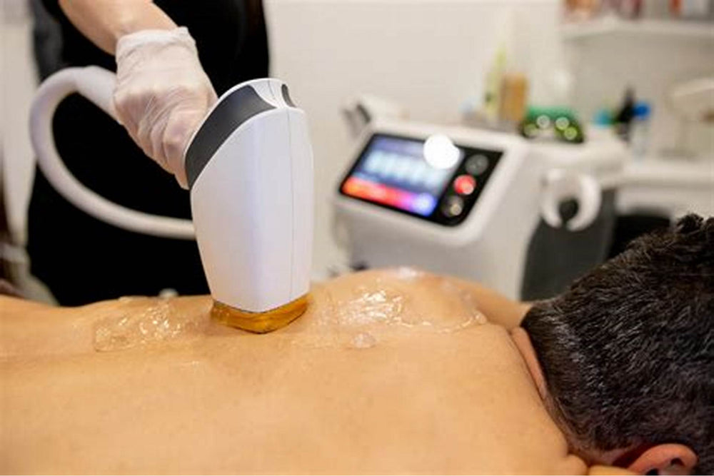 The Perfect Father’s Day Gift: Laser Hair Removal for Men at Skin Mix Medspa