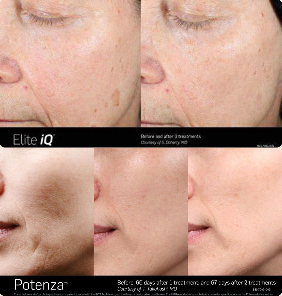 The Ultimate Skin Transformation: Inside the Magic Mix Phenomenon