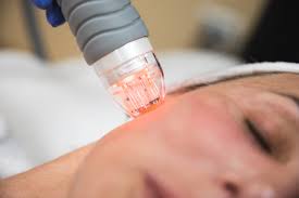 Professional Grade RF Microneedling Denver: Why It's the Best Choice for Flawless Skin